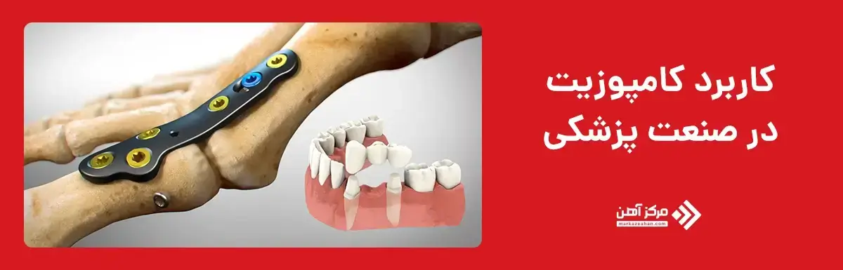 کاربرد کامپوزیت در پزشکی