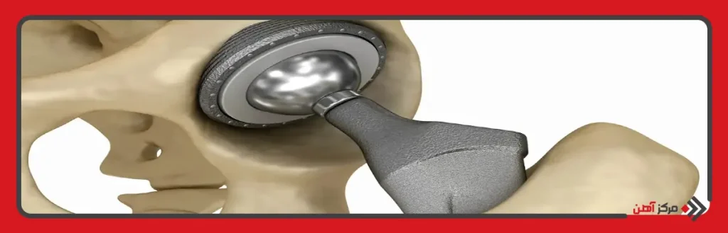 کاربرد تیتانیوم در صنایع پزشکی